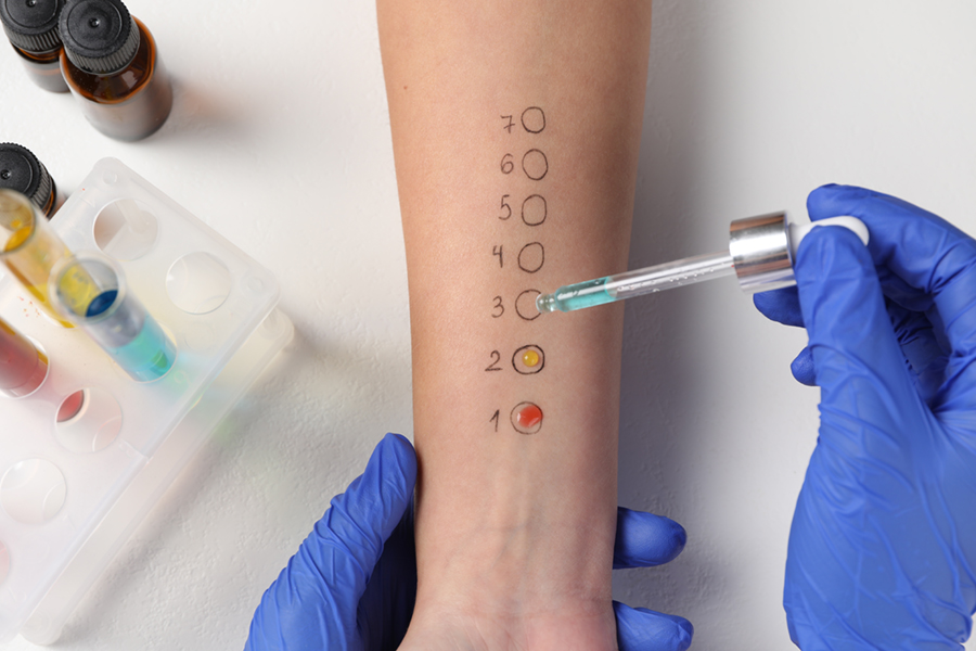 Doctor doing skin allergy test at light table, top view